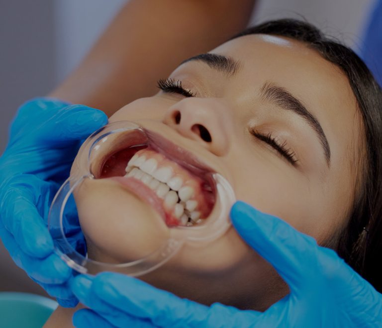 Estetik Gülüş Tasarımı: İdeal Gülüşe Ulaşmanın Yolları